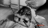 Silmät Ilman Kasvoja *SUOMITXT* (1960, Kauhuklassikko, Georges Franju)